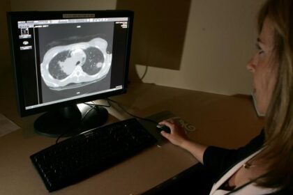 four-types-of-cancer-will-account-for-almost-half-of-new-canadian-cases-this-year:-study