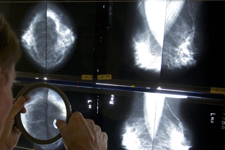 how-breast-cancer-rates-vary-by-region-in-canada