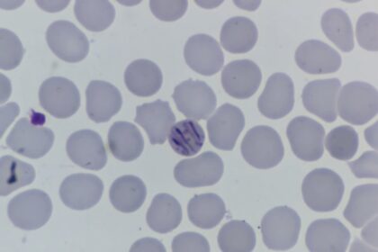 southeastern-ontario-health-unit-probes-114-cases-of-parasitic-stomach-illness