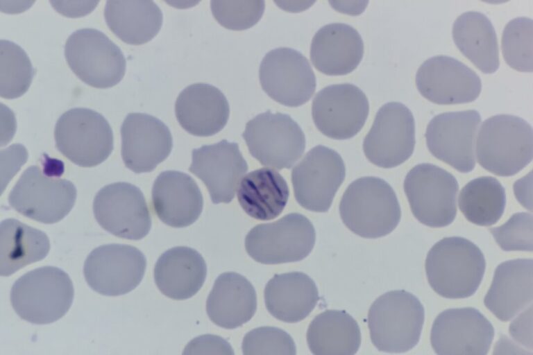 southeastern-ontario-health-unit-probes-114-cases-of-parasitic-stomach-illness