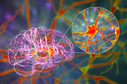 how-your-brain’s-sugar-processing-could-influence-alzheimer’s-disease-risk