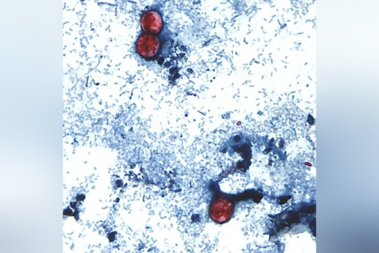 no-cyclospora-outbreaks-reported-or-tainted-lettuce-sold-in-canada,-officials-say