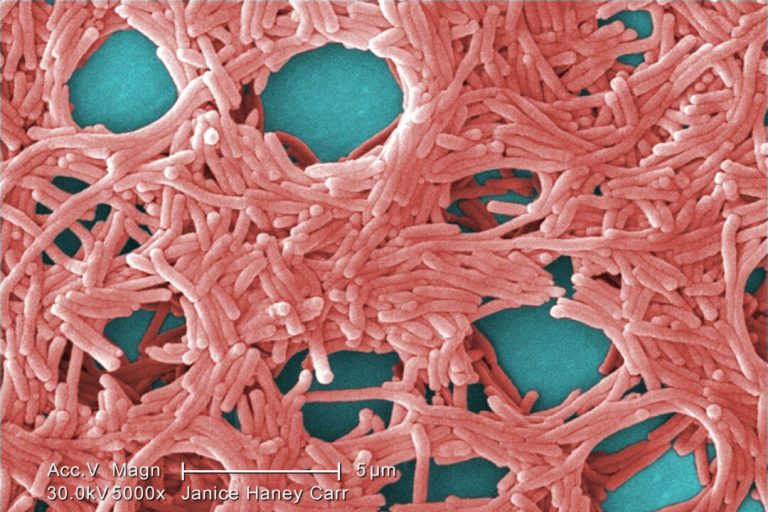 source-of-toronto’s-legionnaires-outbreak-traced-to-cooling-tower,-public-health-says