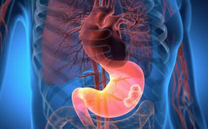 toxic-food-supply-exposed