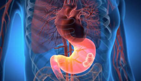 toxic-food-supply-exposed