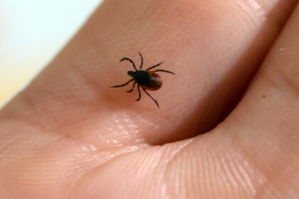 quebec-reports-first-case-of-rocky-mountain-spotted-fever