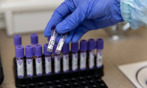 a-blood-smuggling-scandal-reveals-china’s-genetic-security-anxiety