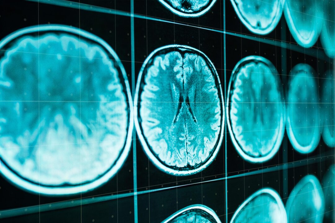 why-does-dementia-take-so-long-to-diagnose?