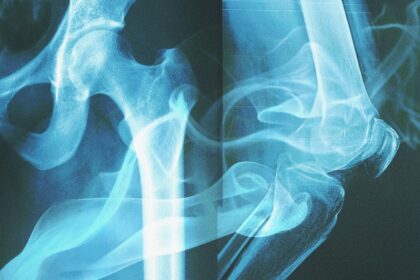 your-bones-‘remember’-the-cigarettes-you-smoked